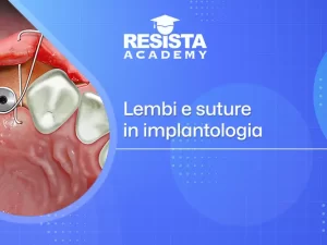 lembi-e-suture-in-implantologia